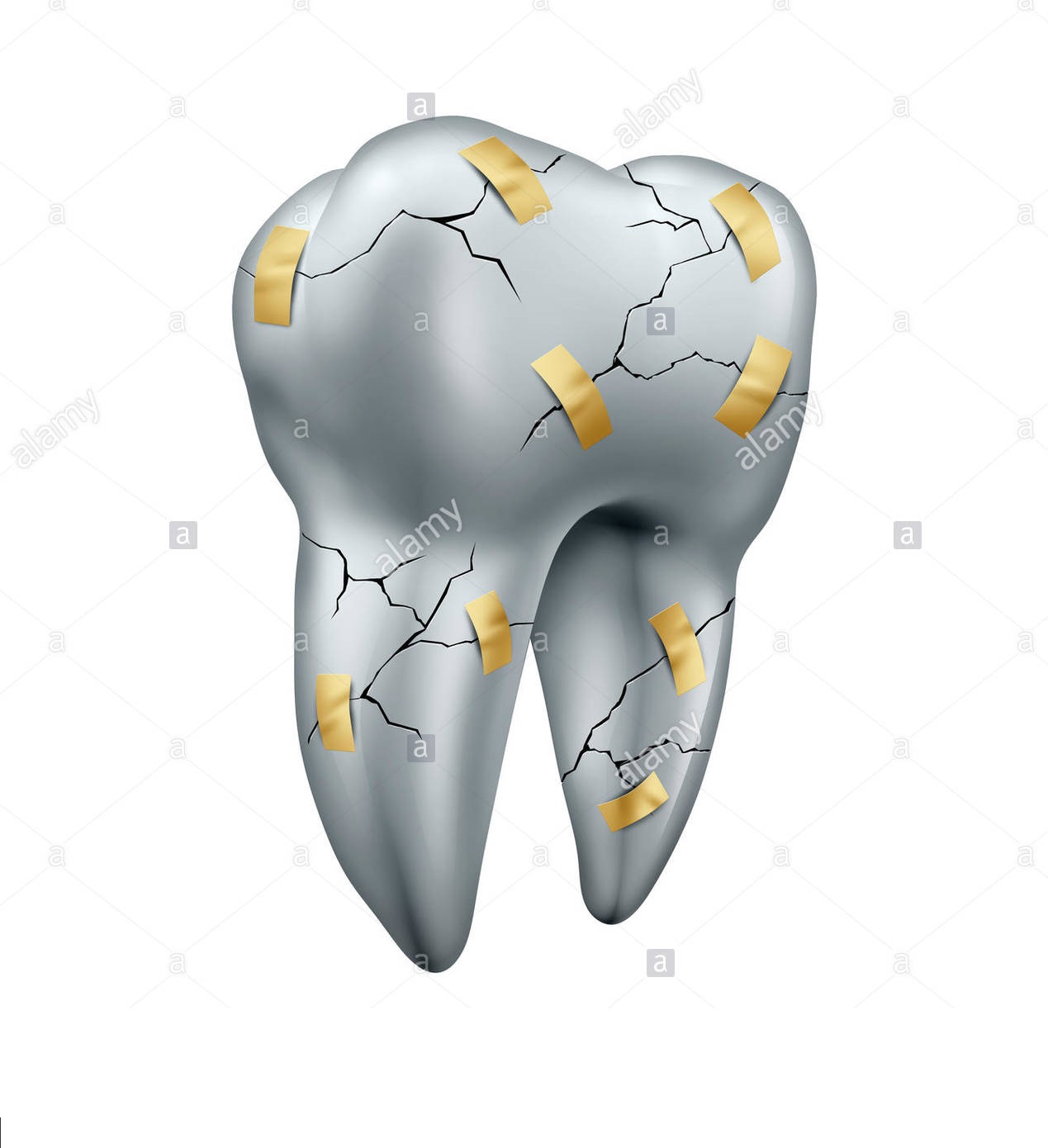 dente--riparazione