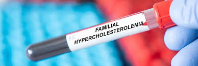 Ipercolesterolemia famigliare