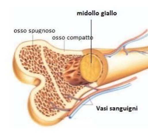 classificazione ossea di Misch per fare gli impianti
